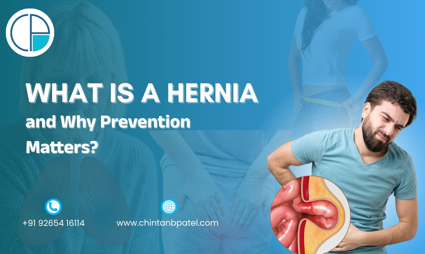 Top 7 Preventive Tips to Avoid Hernia Before It Starts