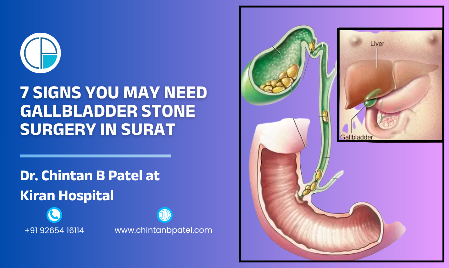 7 Signs You May Need Gallbladder Stone Surgery in Surat